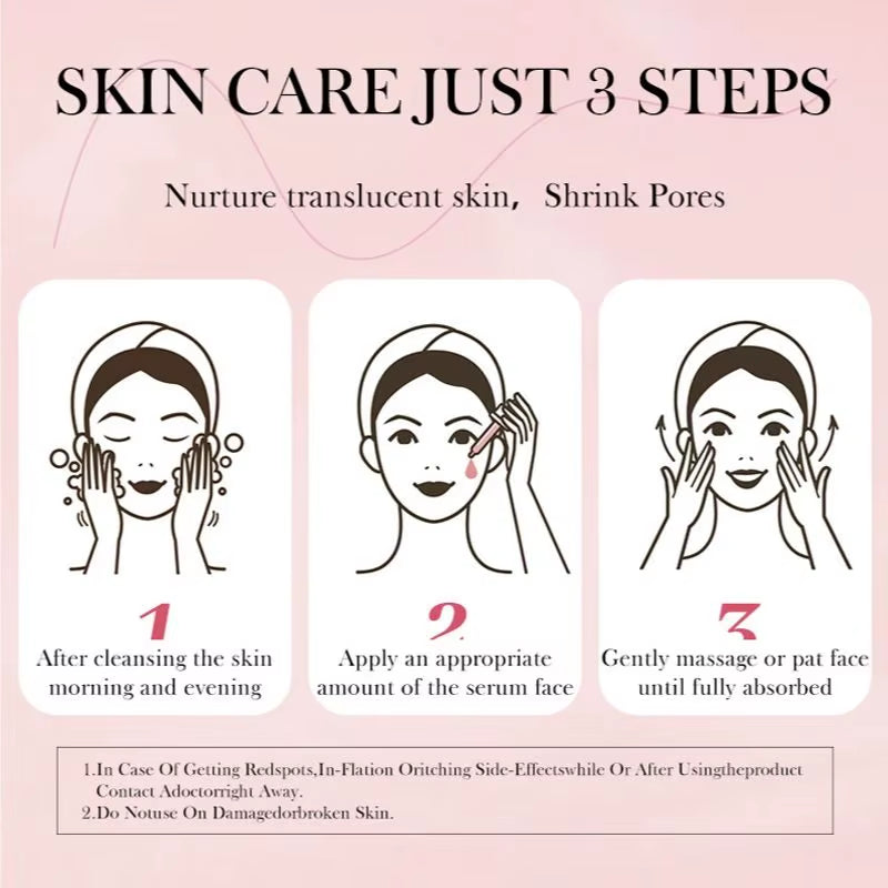 Niacinamide Serum Dark Spot Remover Fade Acne Marks Hyperpigmentation Shrink Pores Even Skin Tone Moisturizing Korea Skin Care 3