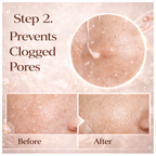 Pore Refine LHA Renewal Cream™