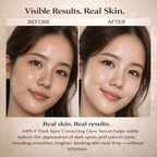 AXIS-Y™ Dark Spot Correcting Glow Serum – 5% Niacinamide Brightening Care