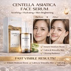 Centella Asiatica Face Serum™ Soothing & Hydrating Korean Skincare