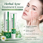 Herbal Acne Treatment Cream™ Oil Control & Blemish Care Skincare