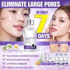 Pore Shrinking™ Serum – Niacinamide Pore Minimizing & Oil Control Care 30ml