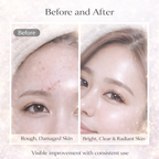 Advanced Snail Repair Cream 92%™ Barrier Recovery Moisturizer