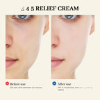 345 Relief Cream Address Blemishes Nourish the Skin and Provide Soothing Care Resulting in a Well-Rounded Skincare Solution