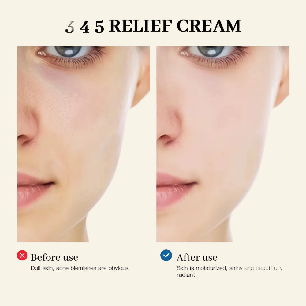 345 Relief Cream Address Blemishes Nourish the Skin and Provide Soothing Care Resulting in a Well-Rounded Skincare Solution
